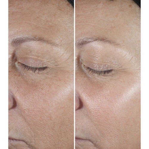 Clinique Smart Sérum Correcteur Anti-Rides 4