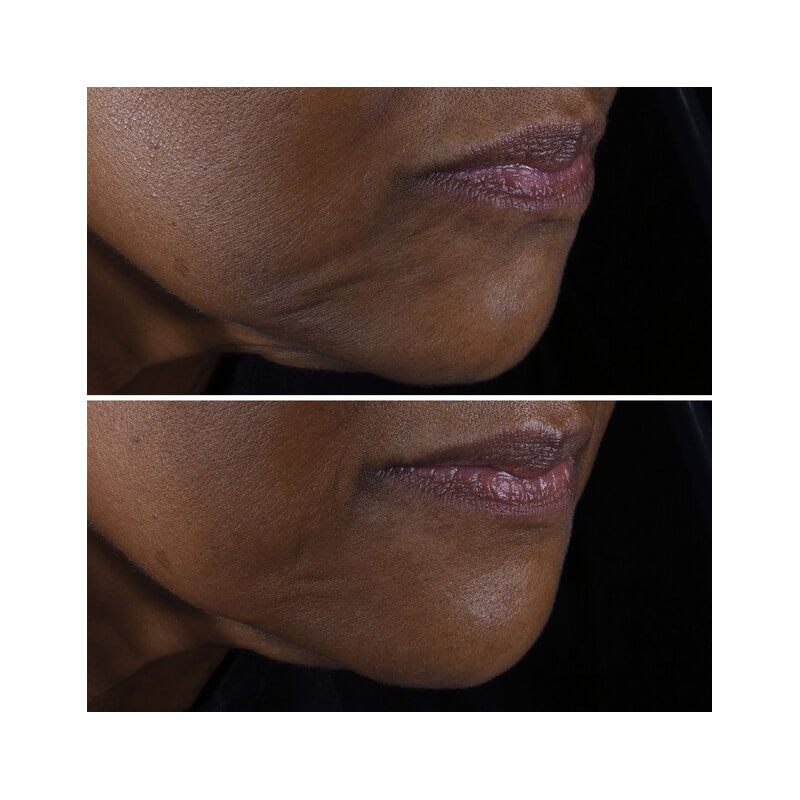 Smart Clinical Repair™ 3