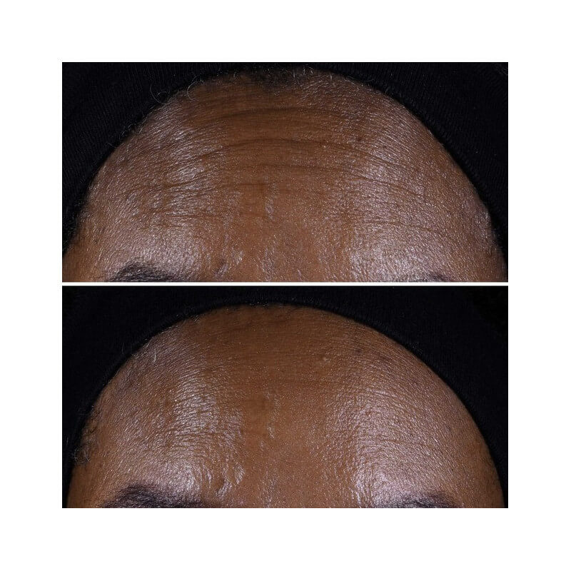 Smart Clinical Repair™ 4