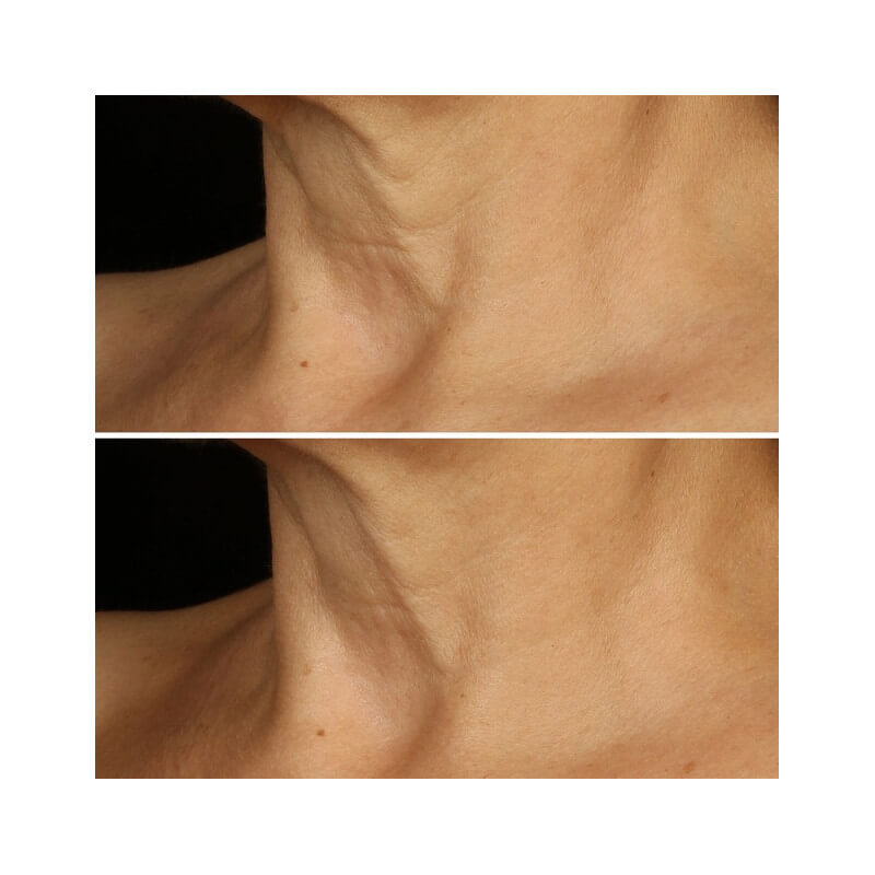 Smart Clinical Repair™ 5
