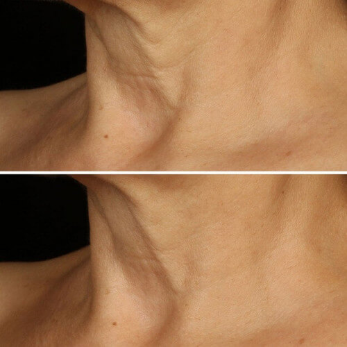 Smart Clinical Repair™ 5