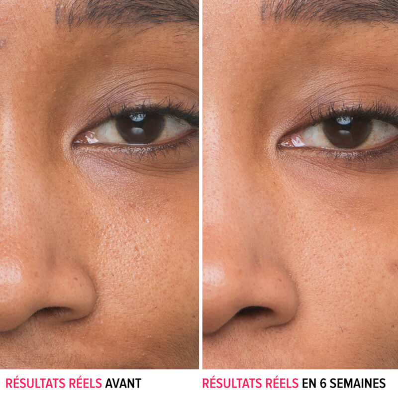 Bye Bye Pores™ 3