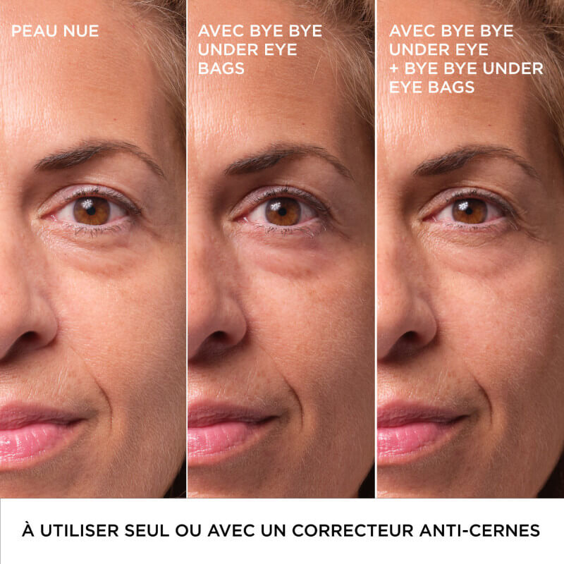 Bye Bye Under Eye Bags 9