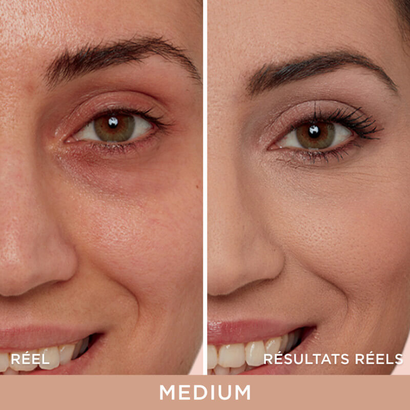 Bye Bye Under Eye™ 2