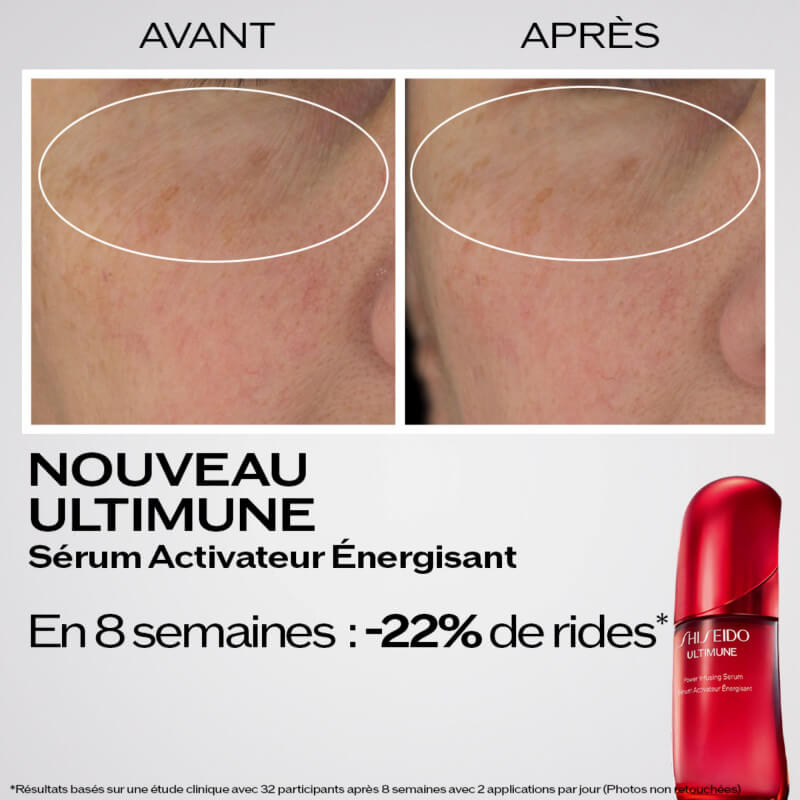 Ultimune 4